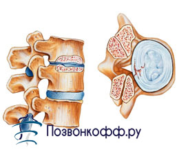 Вылечить дисбактериоз кишечника не лекарствами