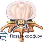 Как ребенку вылечить лающий кашель у ребенка