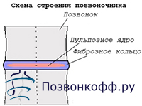 Пролапс диска позвоночника это Пролапс диска позвоночника это