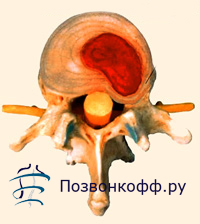 Как влияет остеохондроз на сердечную мышцу, правильное Исцеляющие мудры Школа жизни