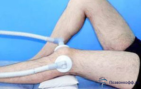 Физеотерапия при тендините коленного сустава