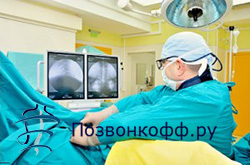 кифоз грудного отдела позвоночника лечение